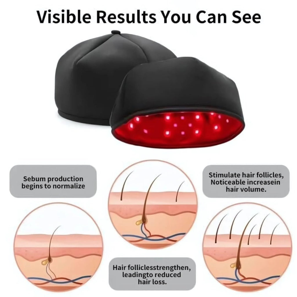 Red Light Therapy Cap - Hair At Nine